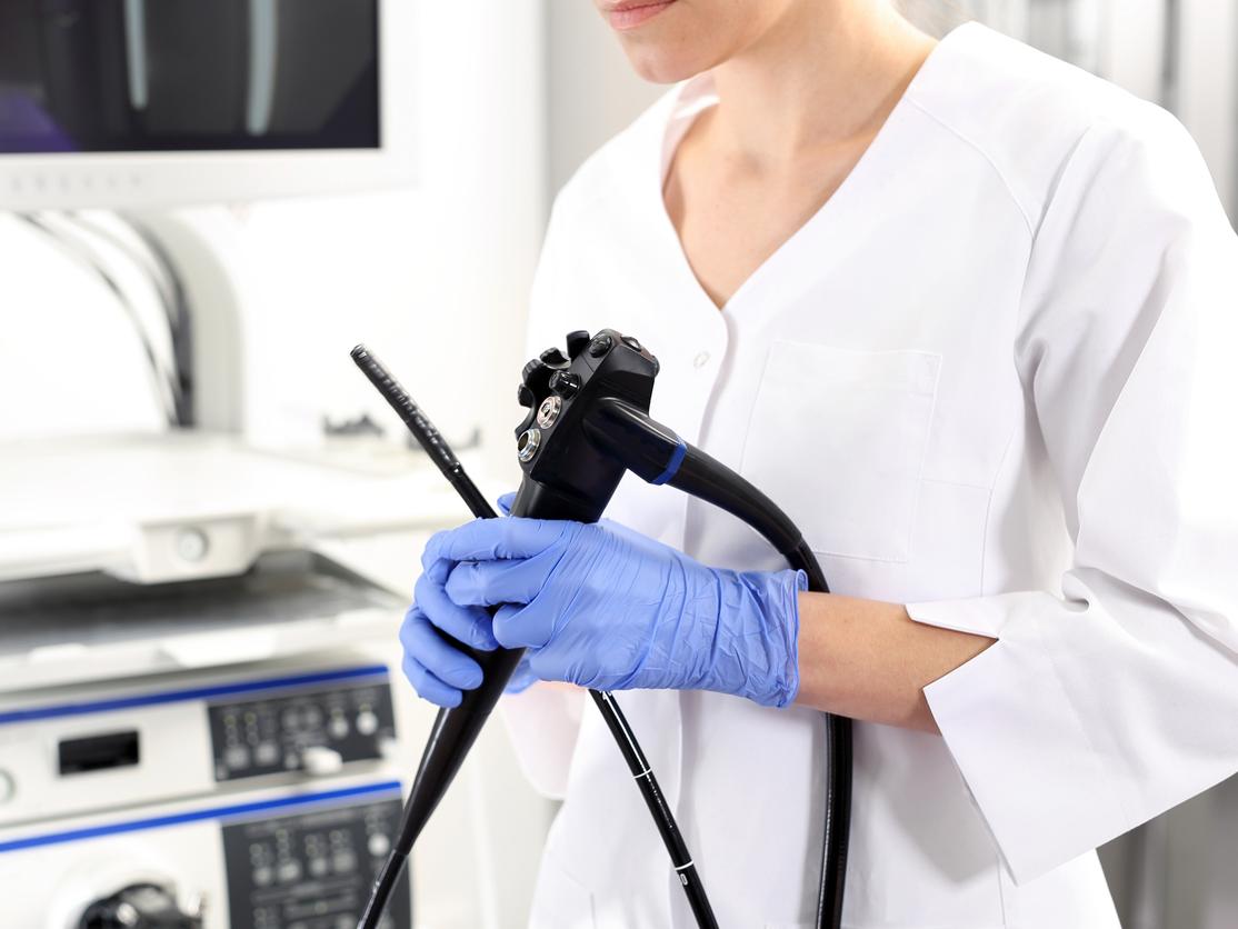 Coloscopie : Quand faut-il en faire une ?