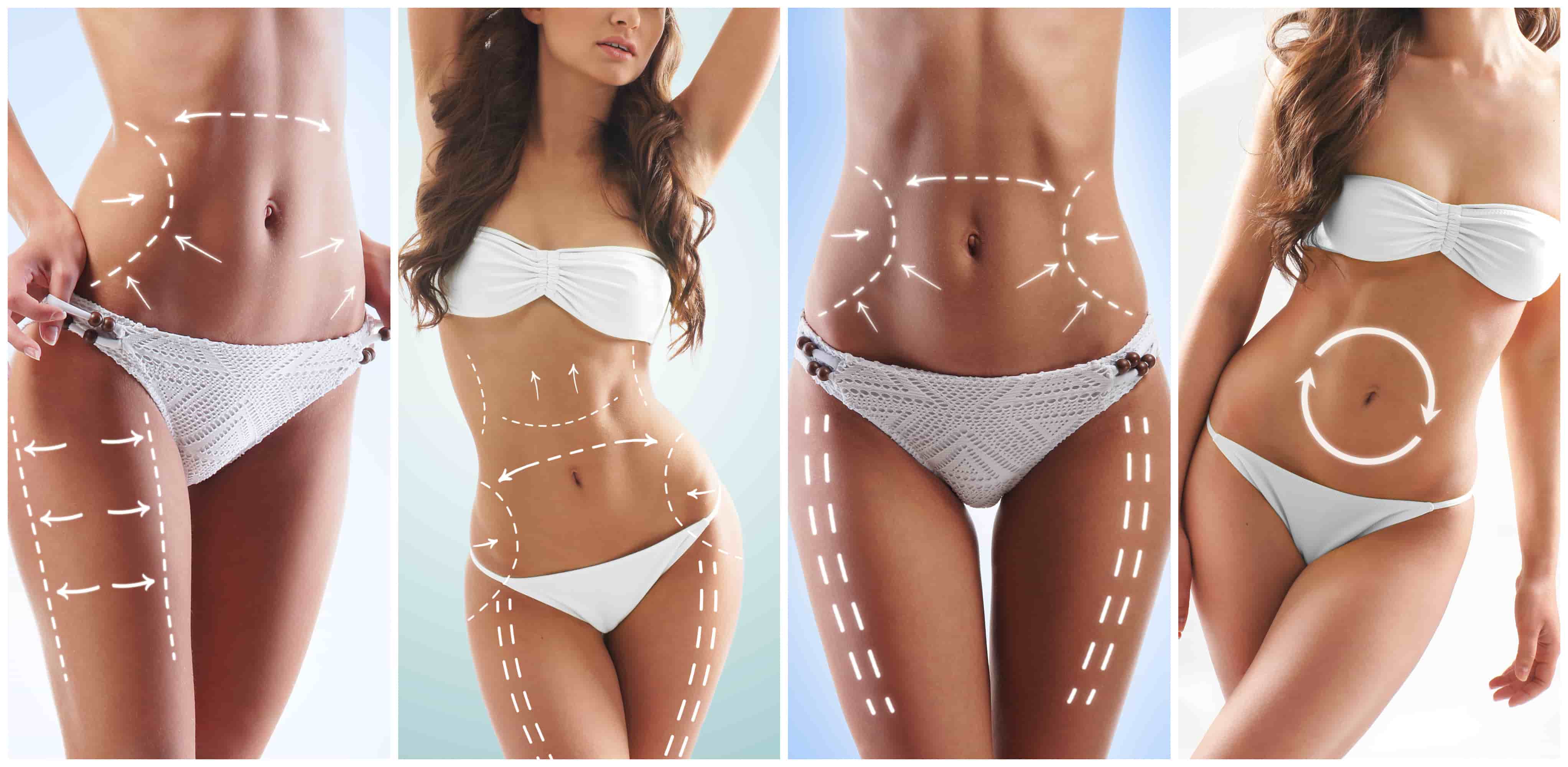 Les 3 opérations de chirurgie esthétique les plus courantes en France